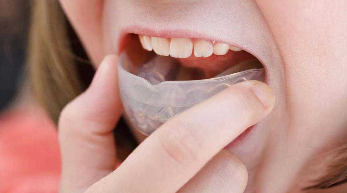 dental appliance for sleep apnea