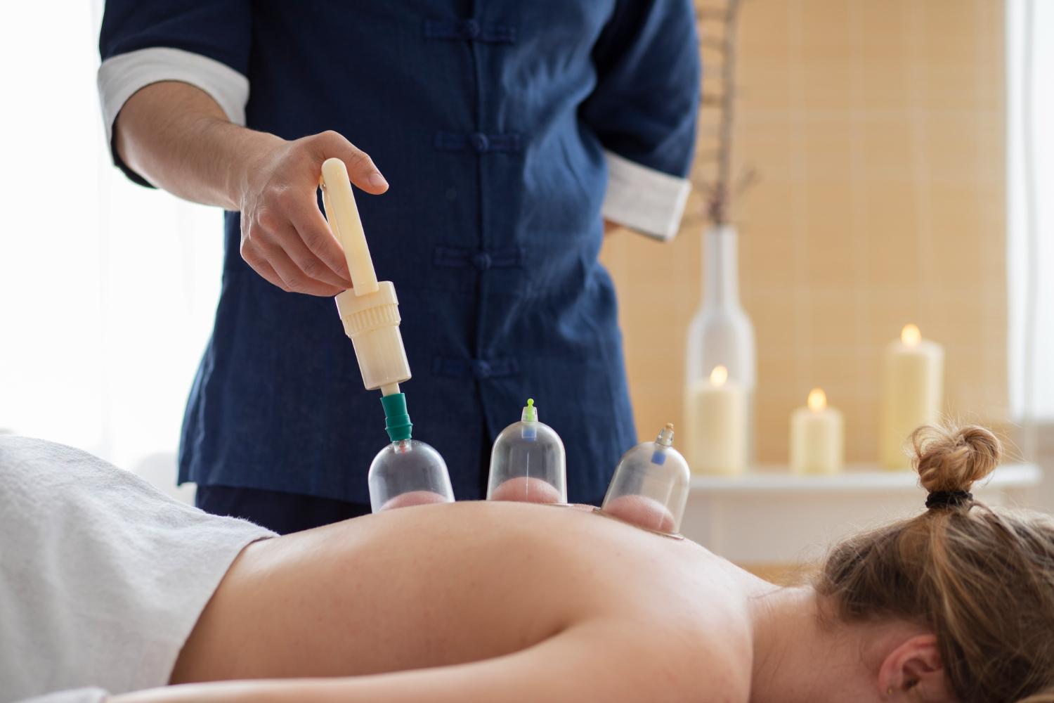 Chinese Acupuncture